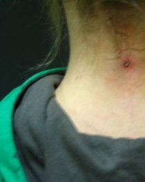 Piercing 01
